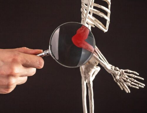 Osteosarcopenia: cuando el hueso y el músculo se debilitan al mismo tiempo